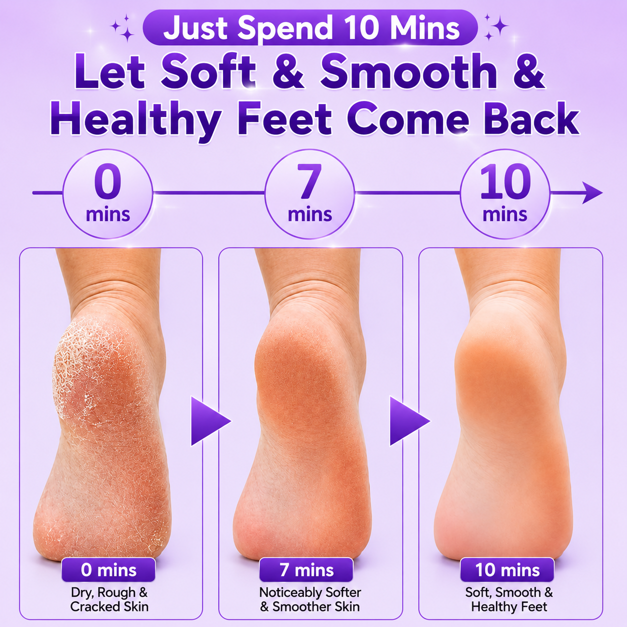 Electric Pedicure Foot File Callus Remover – Rechargeable Foot Care Tool