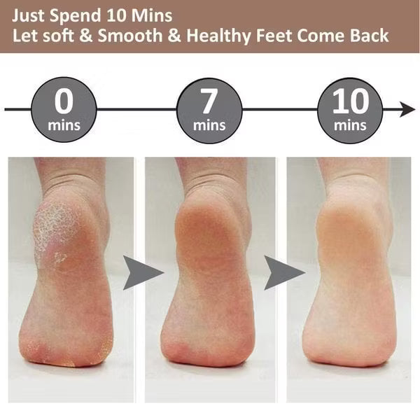 Electric Pedicure Foot File Callus Remover – Rechargeable Foot Care Tool