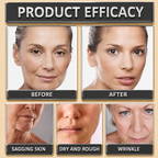 Bee Venom Botox Wrinkle Cream