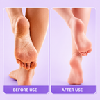 Electric Pedicure Foot File Callus Remover – Rechargeable Foot Care Tool
