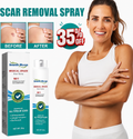 South Moon - Scar Spray